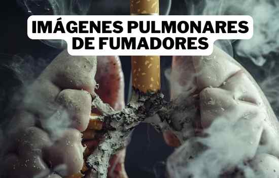 Imágenes Pulmonares de Fumadores: Una Visión Impactante